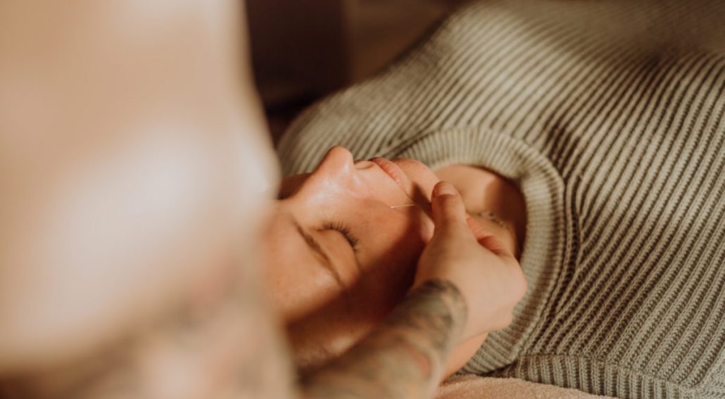 An individual receiving acupuncture treatment, a form of Chinese medicine. Mornington Chinese Medicine