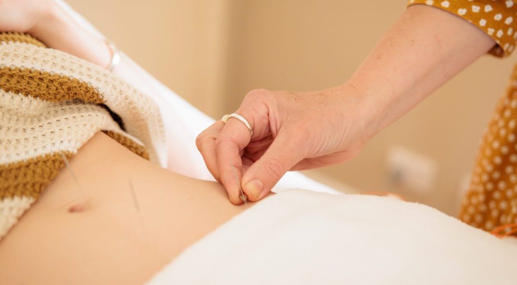 A person receiving treatment in Chinese medicine. Mornington Chinese Medicine